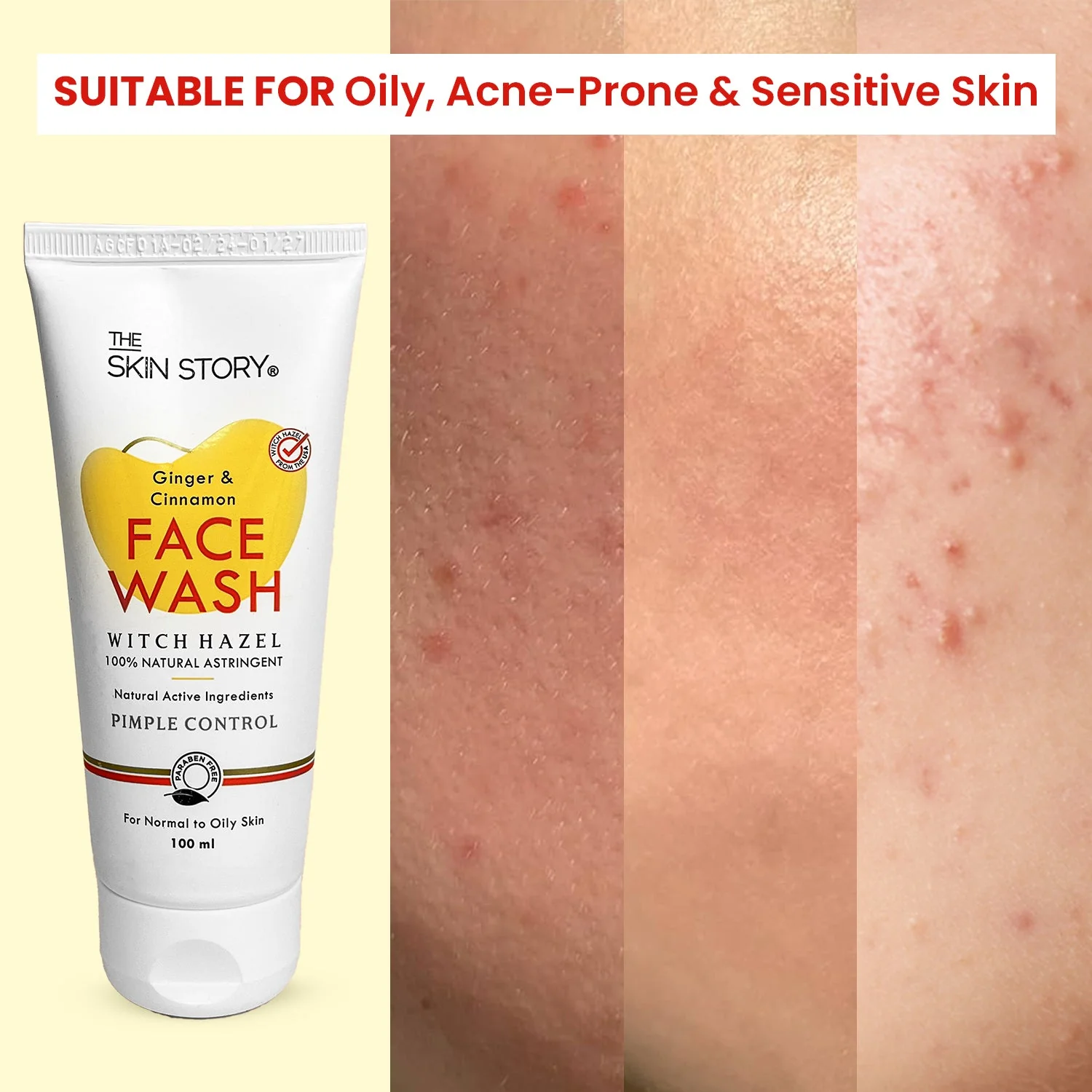 Glow Range for Acne Sentive Skin - Image 5