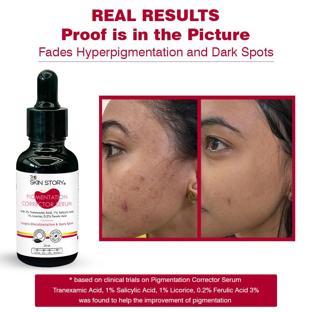 Anti - Pigmentation Combo - Image 7