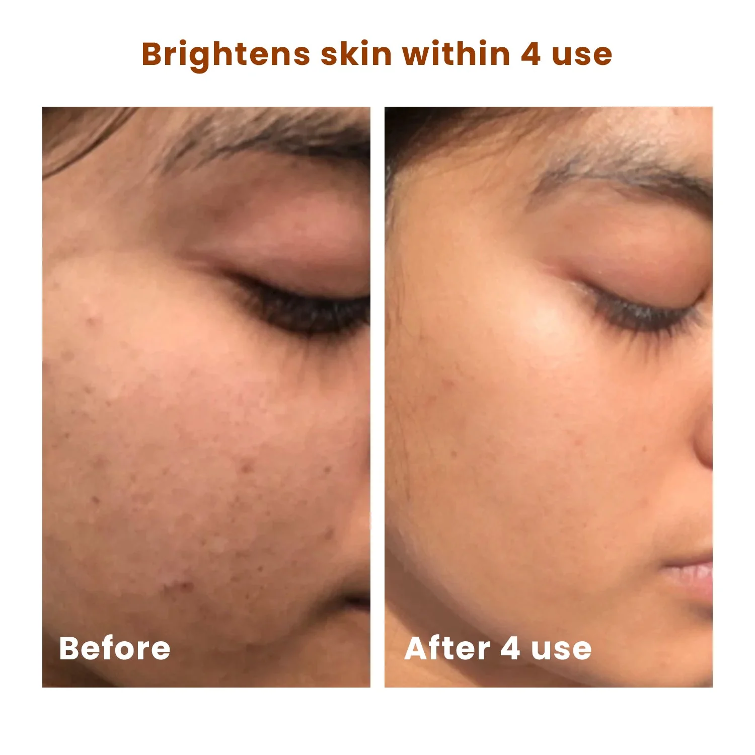 Salicylic Acid BHA Brightening Scrub - Image 8